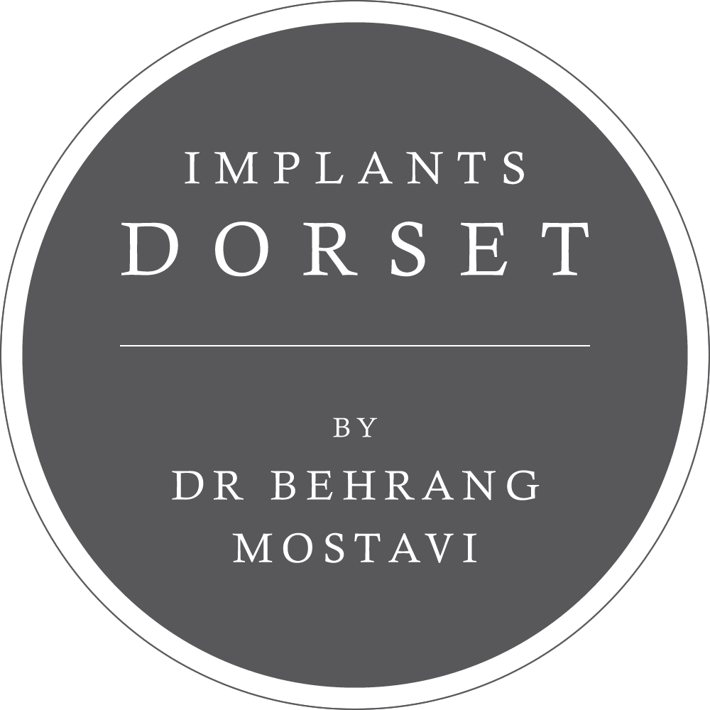 Implants Dorset