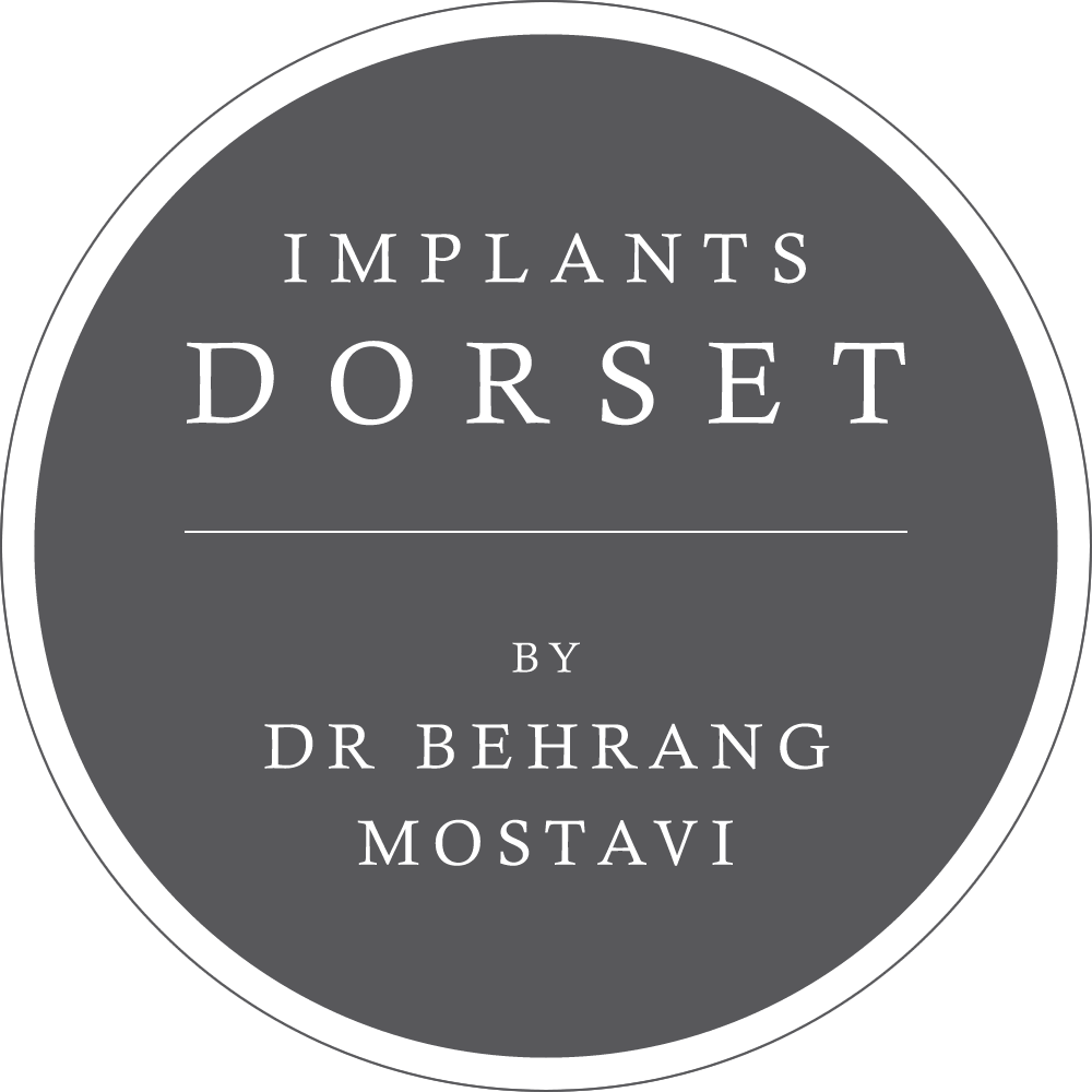 Dental Implants in Weymouth & Dorset